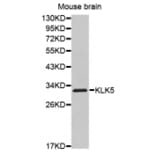 Western blot - KLK5 antibody from Signalway Antibody (38528) - Antibodies.com