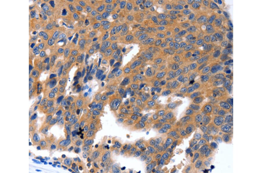 Immunohistochemistry - KLK5 antibody from Signalway Antibody (38528) - Antibodies.com