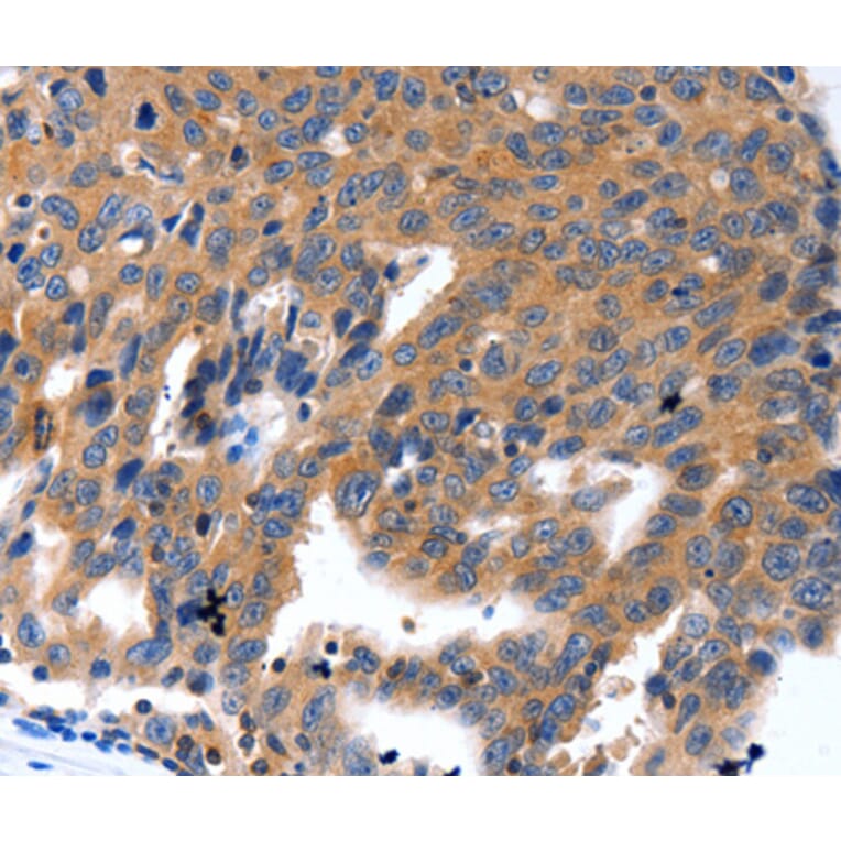 Immunohistochemistry - KLK5 antibody from Signalway Antibody (38528) - Antibodies.com