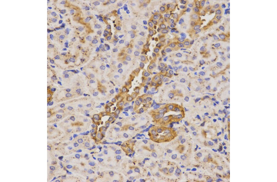Immunohistochemistry - KLK5 antibody from Signalway Antibody (38528) - Antibodies.com