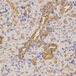 Immunohistochemistry - KLK5 antibody from Signalway Antibody (38528) - Antibodies.com