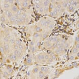 Immunohistochemistry - KLK5 antibody from Signalway Antibody (38528) - Antibodies.com