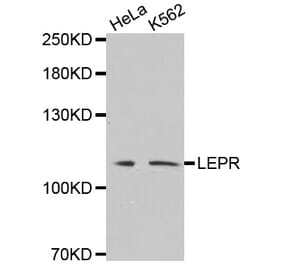 Western blot - LEPR antibody from Signalway Antibody (38530) - Antibodies.com