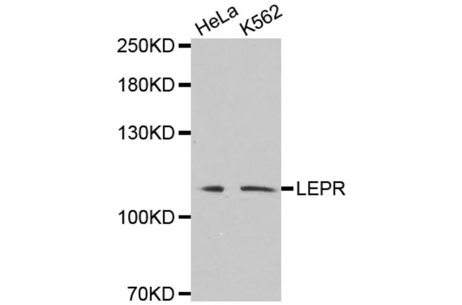 Western blot - LEPR antibody from Signalway Antibody (38530) - Antibodies.com