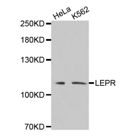Western blot - LEPR antibody from Signalway Antibody (38530) - Antibodies.com