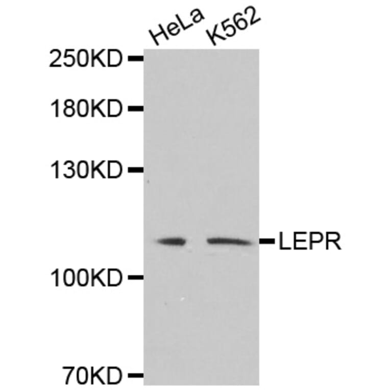 Western blot - LEPR antibody from Signalway Antibody (38530) - Antibodies.com