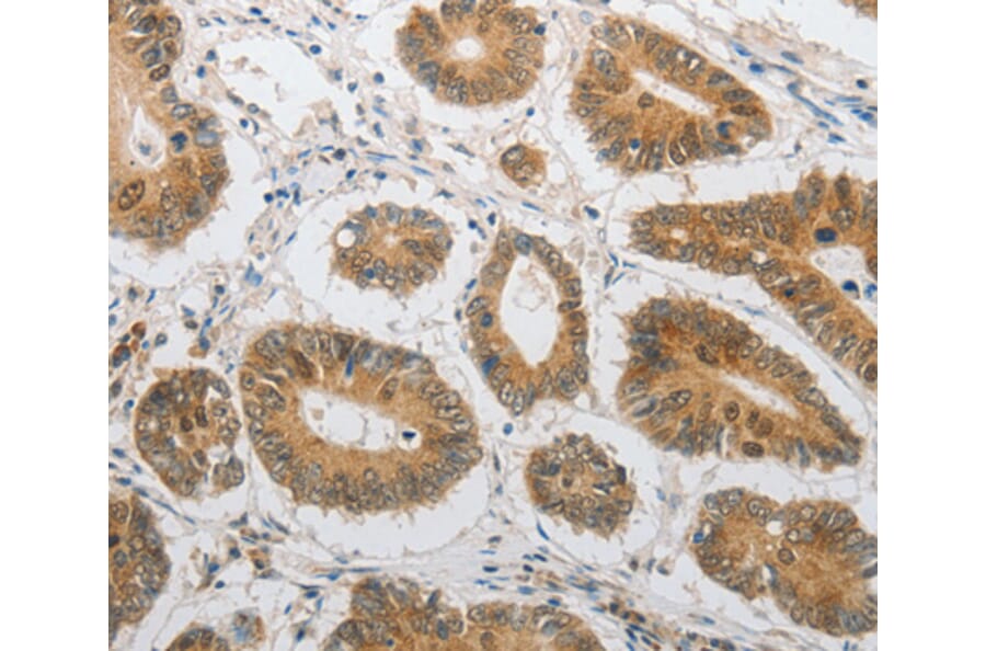 Immunohistochemistry - LEPR antibody from Signalway Antibody (38530) - Antibodies.com