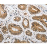 Immunohistochemistry - LEPR antibody from Signalway Antibody (38530) - Antibodies.com