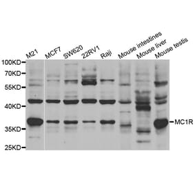 Western blot - MC1R antibody from Signalway Antibody (38533) - Antibodies.com