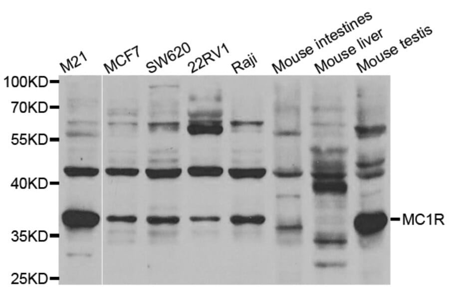 Anti-MC1R Antibody (A38879) | Antibodies.com