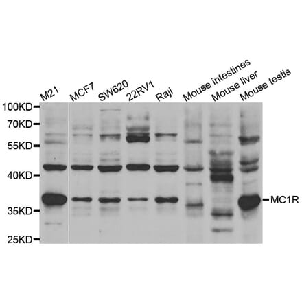 Western blot - MC1R antibody from Signalway Antibody (38533) - Antibodies.com