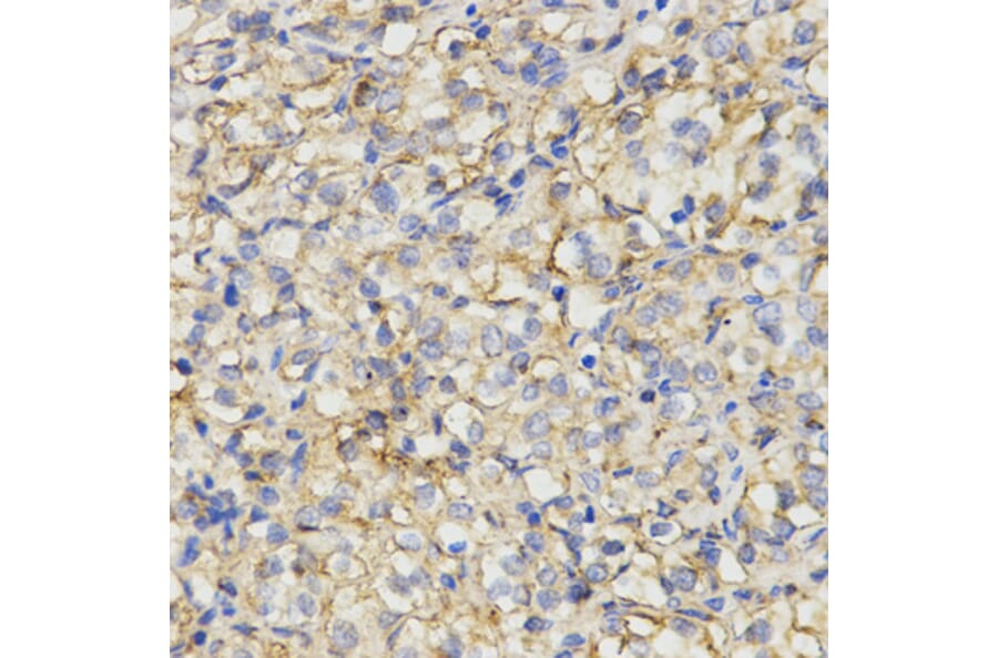 Immunohistochemistry - MC1R antibody from Signalway Antibody (38533) - Antibodies.com