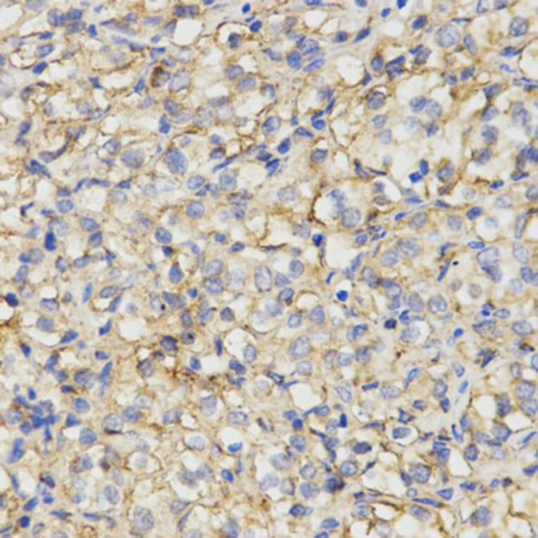 Immunohistochemistry - MC1R antibody from Signalway Antibody (38533) - Antibodies.com