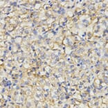 Immunohistochemistry - MC1R antibody from Signalway Antibody (38533) - Antibodies.com
