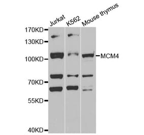 Western blot - MCM4 antibody from Signalway Antibody (38539) - Antibodies.com