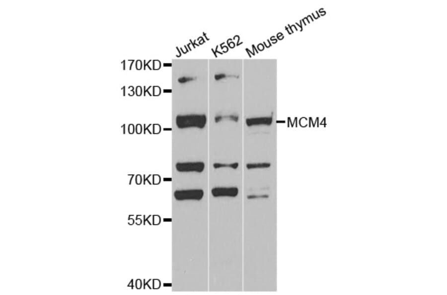 Western blot - MCM4 antibody from Signalway Antibody (38539) - Antibodies.com