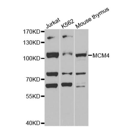 Western blot - MCM4 antibody from Signalway Antibody (38539) - Antibodies.com