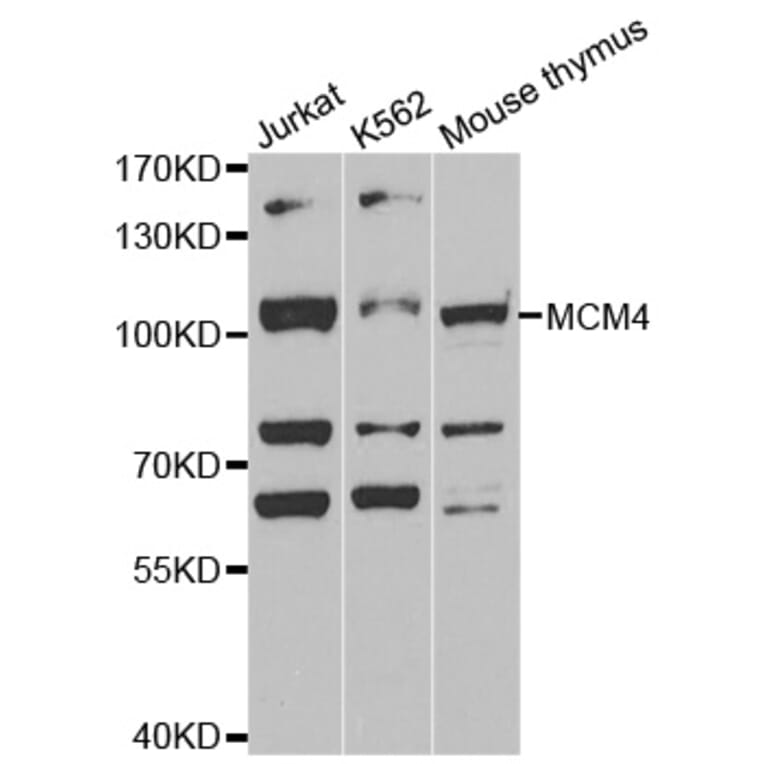 Western blot - MCM4 antibody from Signalway Antibody (38539) - Antibodies.com