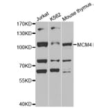 Western blot - MCM4 antibody from Signalway Antibody (38539) - Antibodies.com