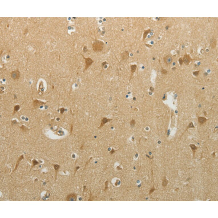 Immunohistochemistry - MCM4 antibody from Signalway Antibody (38539) - Antibodies.com