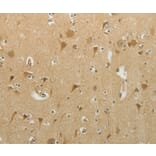 Immunohistochemistry - MCM4 antibody from Signalway Antibody (38539) - Antibodies.com