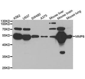 Western blot - MMP8 antibody from Signalway Antibody (38543) - Antibodies.com