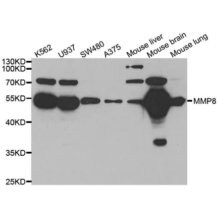 Western blot - MMP8 antibody from Signalway Antibody (38543) - Antibodies.com