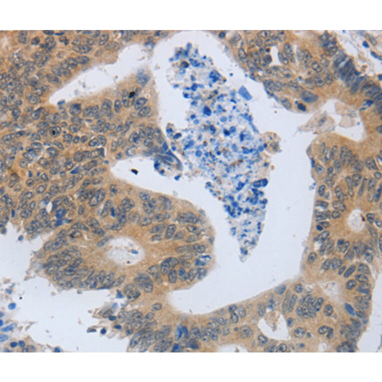 Immunohistochemistry - MMP8 antibody from Signalway Antibody (38543) - Antibodies.com