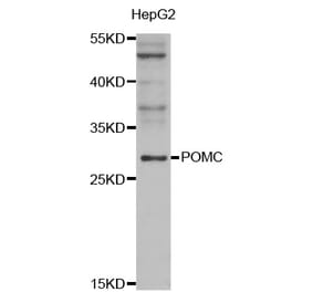 Western blot - POMC antibody from Signalway Antibody (38547) - Antibodies.com
