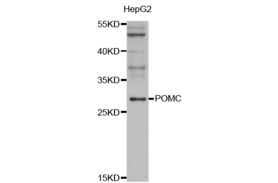 Western blot - POMC antibody from Signalway Antibody (38547) - Antibodies.com