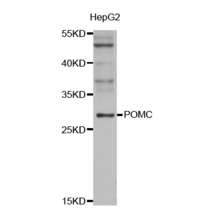 Western blot - POMC antibody from Signalway Antibody (38547) - Antibodies.com