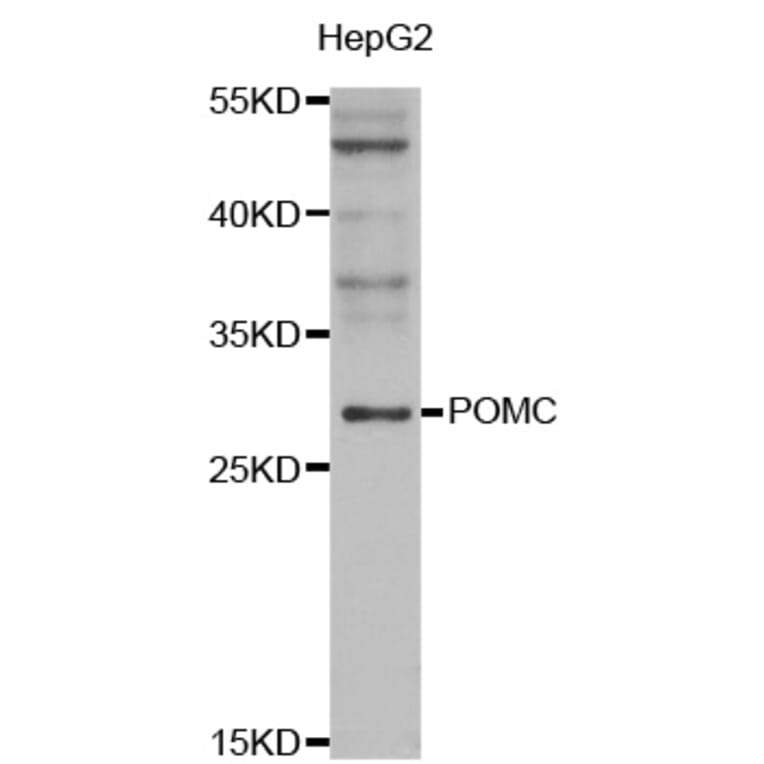 Western blot - POMC antibody from Signalway Antibody (38547) - Antibodies.com