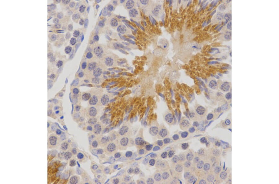 Immunohistochemistry - POMC antibody from Signalway Antibody (38547) - Antibodies.com