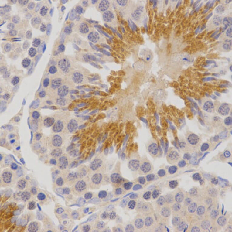 Immunohistochemistry - POMC antibody from Signalway Antibody (38547) - Antibodies.com