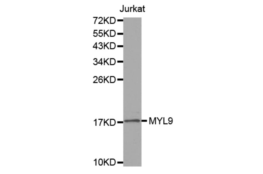 Western blot - MYL9 antibody from Signalway Antibody (38548) - Antibodies.com