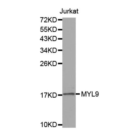Western blot - MYL9 antibody from Signalway Antibody (38548) - Antibodies.com