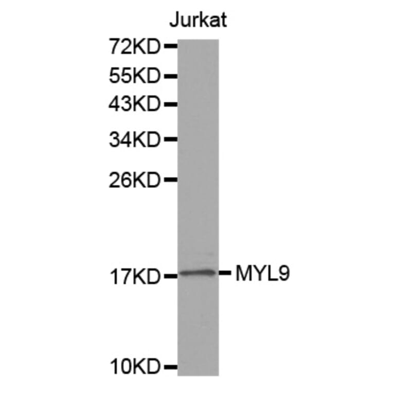 Western blot - MYL9 antibody from Signalway Antibody (38548) - Antibodies.com