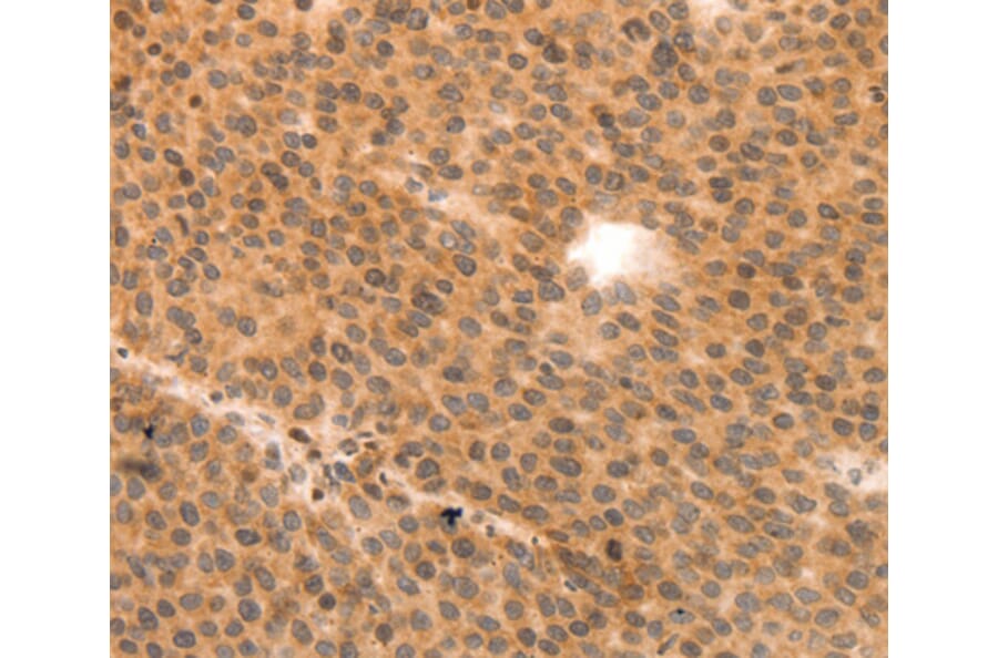 Immunohistochemistry - MYL9 antibody from Signalway Antibody (38548) - Antibodies.com