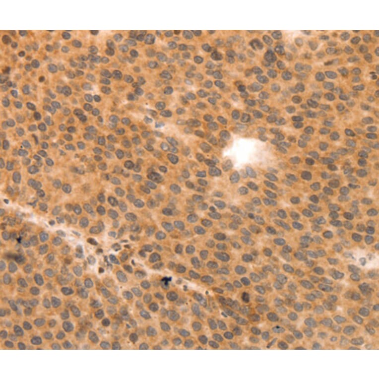 Immunohistochemistry - MYL9 antibody from Signalway Antibody (38548) - Antibodies.com