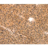 Immunohistochemistry - MYL9 antibody from Signalway Antibody (38548) - Antibodies.com