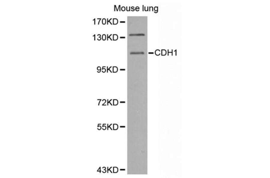 Western blot - CDH1 antibody from Signalway Antibody (38550) - Antibodies.com