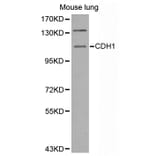 Western blot - CDH1 antibody from Signalway Antibody (38550) - Antibodies.com