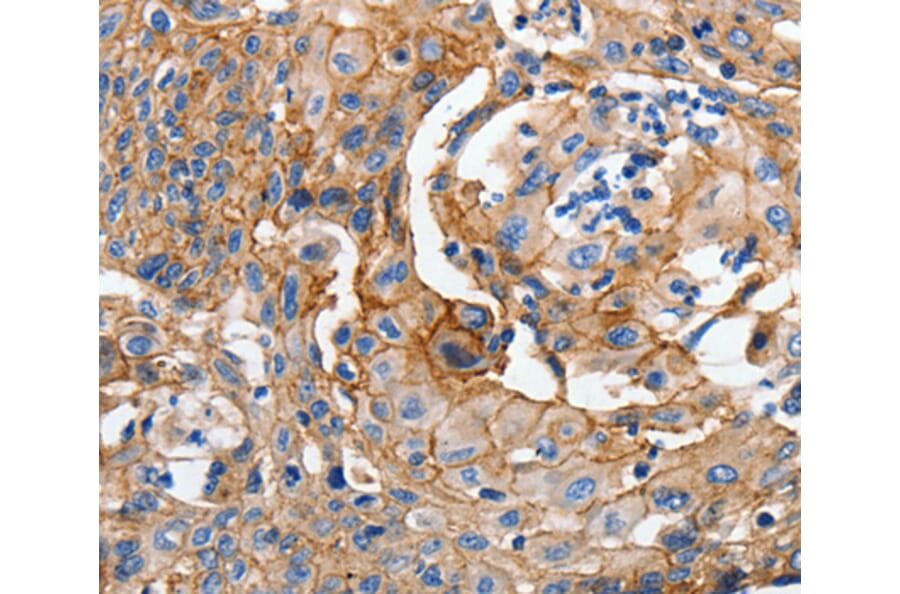 Immunohistochemistry - CDH1 antibody from Signalway Antibody (38550) - Antibodies.com