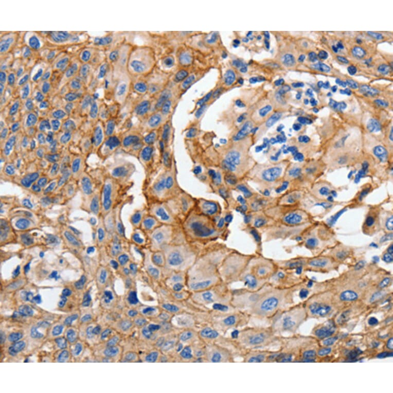 Immunohistochemistry - CDH1 antibody from Signalway Antibody (38550) - Antibodies.com