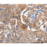 Immunohistochemistry - CDH1 antibody from Signalway Antibody (38550) - Antibodies.com