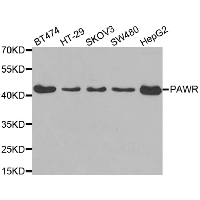 Western blot - PAWR antibody from Signalway Antibody (38558) - Antibodies.com