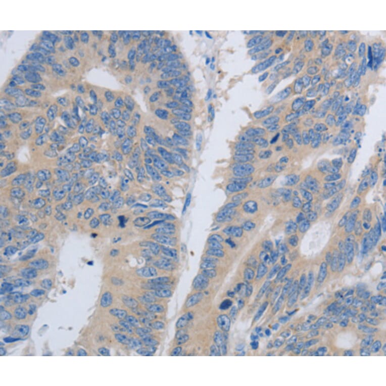 Immunohistochemistry - PAWR antibody from Signalway Antibody (38558) - Antibodies.com