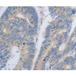 Immunohistochemistry - PAWR antibody from Signalway Antibody (38558) - Antibodies.com