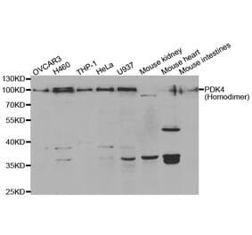 Western blot - PDK4 antibody from Signalway Antibody (38562) - Antibodies.com