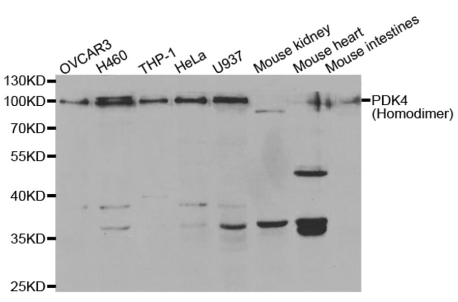Western blot - PDK4 antibody from Signalway Antibody (38562) - Antibodies.com
